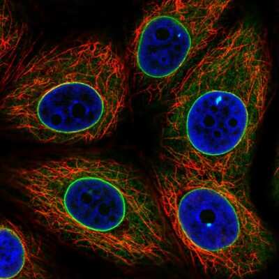 Immunocytochemistry/ Immunofluorescence: Emerin Antibody (CL0203) [NBP2-52877]