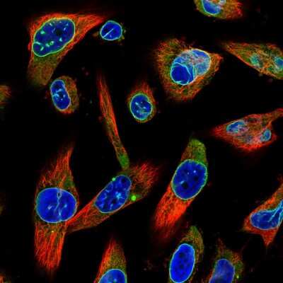 Immunocytochemistry/ Immunofluorescence: Emerin Antibody (CL0203) [NBP2-52877]