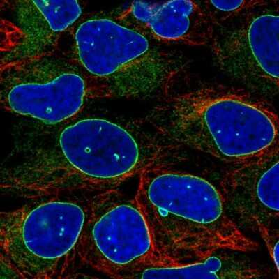 Immunocytochemistry/ Immunofluorescence: Emerin Antibody (CL0203) [NBP2-52877]