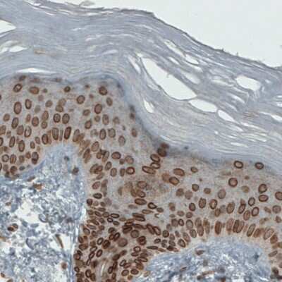 Immunohistochemistry-Paraffin: Emerin Antibody (CL0203) [NBP2-52877]