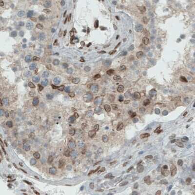 Immunohistochemistry-Paraffin: Emerin Antibody (CL0203) [NBP2-52877]