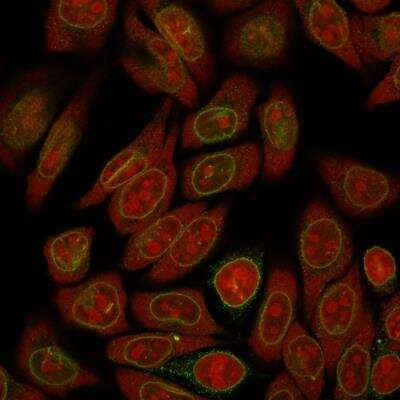 Immunocytochemistry/ Immunofluorescence: Emerin Antibody (EMD/2167) - Azide and BSA Free [NBP2-79918]