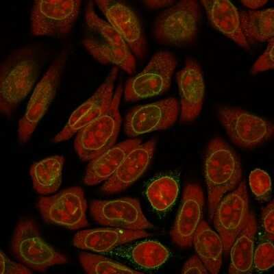 Immunocytochemistry/ Immunofluorescence: Emerin Antibody (EMD/2167) [NBP2-79784]