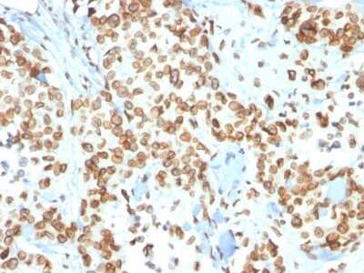Immunohistochemistry-Paraffin: Emerin Antibody (EMD/2167) [NBP2-79784]