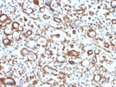 Immunohistochemistry-Paraffin: Emerin Antibody (EMD/2167) [NBP2-79784]