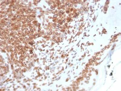 Immunohistochemistry-Paraffin: Emerin Antibody (EMD/2168) [NBP3-07151]