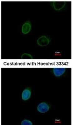 Immunocytochemistry/ Immunofluorescence: Emerin Antibody [NBP2-16326]