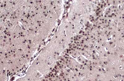 Immunohistochemistry-Paraffin: Emx1 Antibody [NBP3-13392]