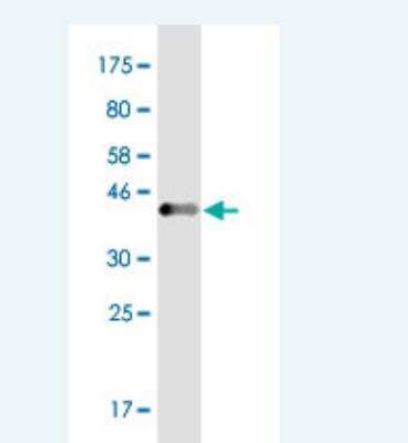 Western Blot: Enah/Vasp-like Antibody (1D6) [H00051466-M02]