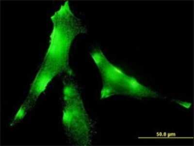 Immunocytochemistry/ Immunofluorescence: Enah/Vasp-like Antibody (5G1) [H00051466-M01]