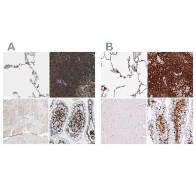 Immunohistochemistry-Paraffin: Enah/Vasp-like Antibody [NBP1-80831]