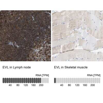 Immunohistochemistry-Paraffin: Enah/Vasp-like Antibody [NBP1-80831]