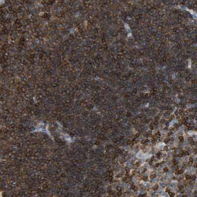 Immunohistochemistry-Paraffin: Enah/Vasp-like Antibody [NBP1-80831]