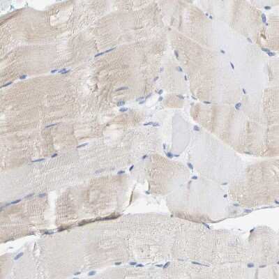 Immunohistochemistry-Paraffin: Enah/Vasp-like Antibody [NBP1-80831]