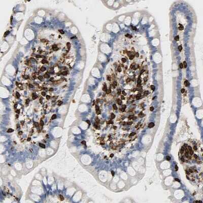Immunohistochemistry-Paraffin: Enah/Vasp-like Antibody [NBP1-80831]