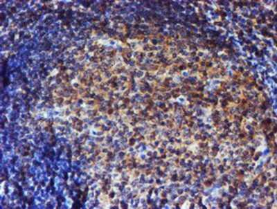 Immunohistochemistry-Paraffin: Endo G Antibody (OTI5F1) [NBP2-01696]