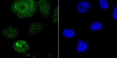 Immunocytochemistry/ Immunofluorescence: Endo G Antibody (JU31-30) [NBP2-75480]