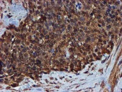 Immunohistochemistry: Endo G Antibody (OTI5F1) - Azide and BSA Free [NBP2-70645]