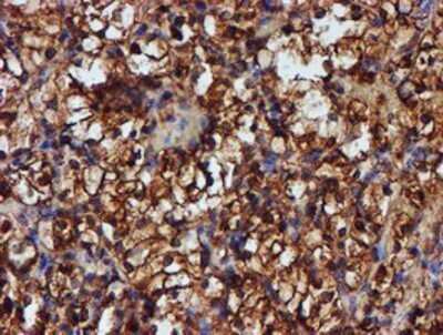Immunohistochemistry: Endo G Antibody (OTI5F1) - Azide and BSA Free [NBP2-70645]
