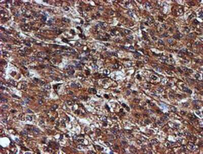 Immunohistochemistry: Endo G Antibody (OTI5F1) - Azide and BSA Free [NBP2-70645]