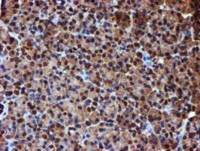 Immunohistochemistry: Endo G Antibody (OTI5F1) - Azide and BSA Free [NBP2-70645]