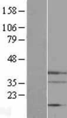Western Blot: Endo G Overexpression Lysate [NBL1-10264]