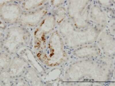 Immunohistochemistry-Paraffin: Endocan/ESM-1 Antibody (6D4) [H00011082-M02]