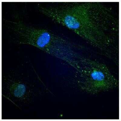 Immunocytochemistry/ Immunofluorescence: Endoglin/CD105 Antibody (3A9) - Azide and BSA Free [NBP2-80719]