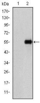 Western Blot: Endoglin/CD105 Antibody (3A9)Azide and BSA Free [NBP2-80719]
