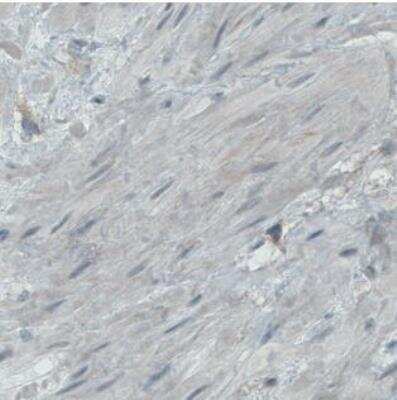 Immunohistochemistry-Paraffin: Endoglin/CD105 Antibody (CL1912) [NBP2-34493]