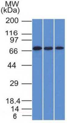 Western Blot: Endoglin/CD105 Antibody (ENG/1326) [NBP2-53327]