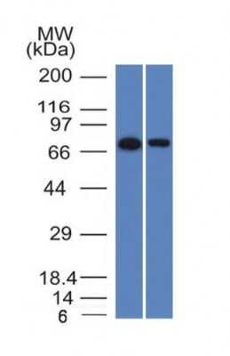 Western Blot: Endoglin/CD105 Antibody (ENG/1327)Azide and BSA Free [NBP2-54517]