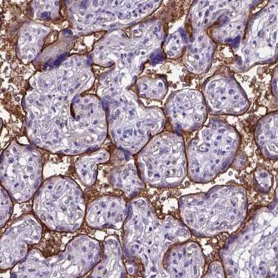 Immunohistochemistry: Endoglin/CD105 Antibody [NBP2-49516]