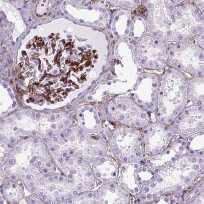 Immunohistochemistry-Paraffin: Endoglin/CD105 Antibody [NBP2-49516]