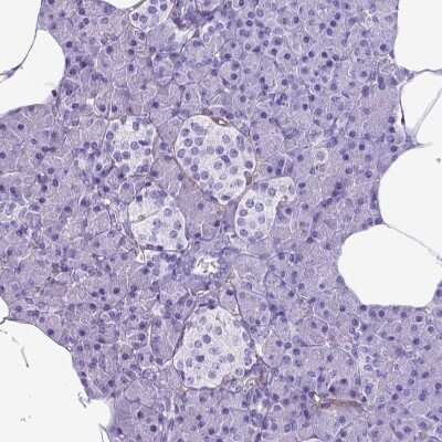 Immunohistochemistry-Paraffin: Endoglin/CD105 Antibody [NBP2-49516]