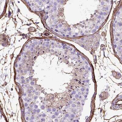 Immunohistochemistry-Paraffin: Endoglin/CD105 Antibody [NBP2-49516]