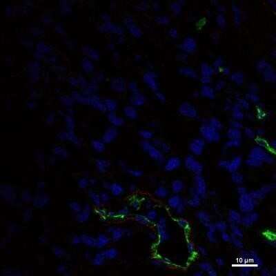 Immunocytochemistry/ Immunofluorescence: Endoglin/CD105 Antibody (MJ7/18) - Azide and BSA Free [NBP2-80718]