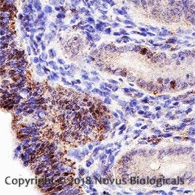 Immunohistochemistry-Paraffin: Endoglin/CD105 Antibody (MJ7/18) - Azide and BSA Free [NBP2-80718]