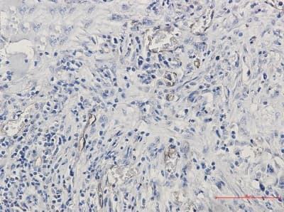 Immunohistochemistry-Paraffin: Endoglin/CD105 Antibody (S05-3H7) [NBP3-14875]