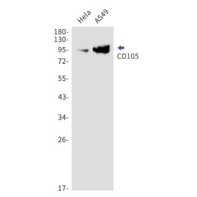 Western Blot: Endoglin/CD105 Antibody (S05-3H7) [NBP3-14875]