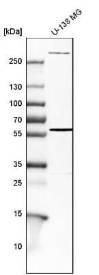 Western Blot: Endoglin/CD105 Antibody [NBP1-91212]