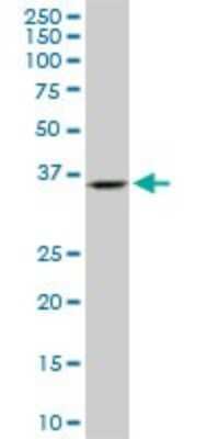 Western Blot: Endophilin A1/SH3GL2 Antibody (2G6) [H00006456-M06]
