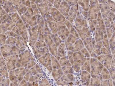 Immunohistochemistry-Paraffin: Endosialin/CD248/TEM1 Antibody [NBP2-99057]