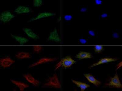 Immunocytochemistry/ Immunofluorescence: Endothelial Lipase Antibody [NB400-118]