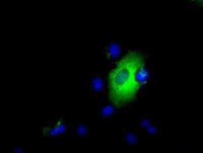 Immunocytochemistry/ Immunofluorescence: Endothelial Lipase Antibody (OTI1D9) - Azide and BSA Free [NBP2-71309]