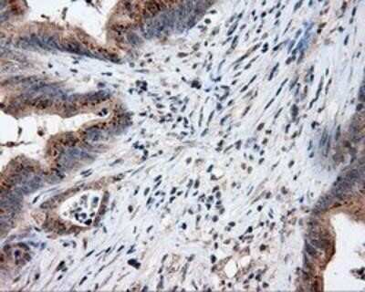 Immunohistochemistry: Endothelial Lipase Antibody (OTI1D9) - Azide and BSA Free [NBP2-71309]