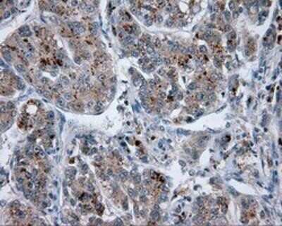 Immunohistochemistry: Endothelial Lipase Antibody (OTI1D9) - Azide and BSA Free [NBP2-71309]