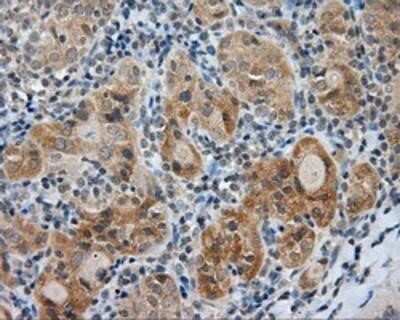 Immunohistochemistry-Paraffin: Endothelial Lipase Antibody (OTI1D9) [NBP2-02396]