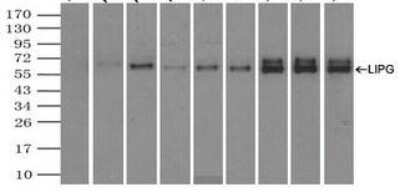 Immunoprecipitation: Endothelial Lipase Antibody (OTI1D9) [NBP2-02396]