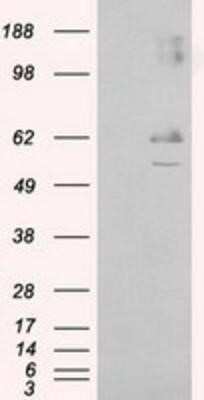 Western Blot: Endothelial Lipase Antibody (OTI1D9) [NBP2-02396]